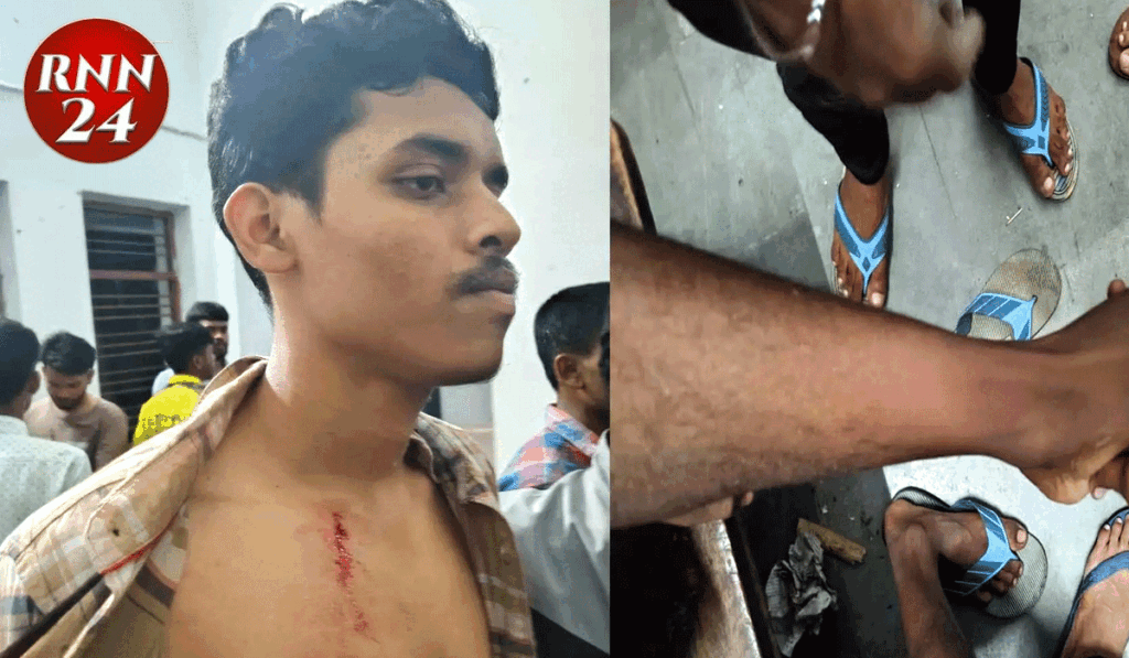 हॉस्टल में घुसकर हमला, छात्र घायल