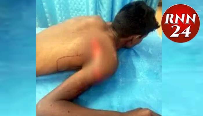 स्वामी आत्मानंद स्कूल में चाकूबाजी की वारदात, एक छात्र ने सहपाठी पर किया हमला स्वामी आत्मानंद स्कूल
