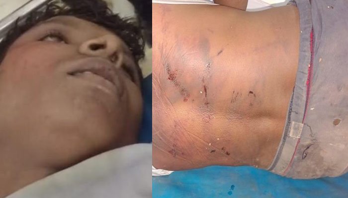 अपहरण के बाद युवक की निर्मम हत्या- घायल अवस्था में घर के पास फेंक गए आरोपी, पुलिस जांच में जुटी युवक हत्या