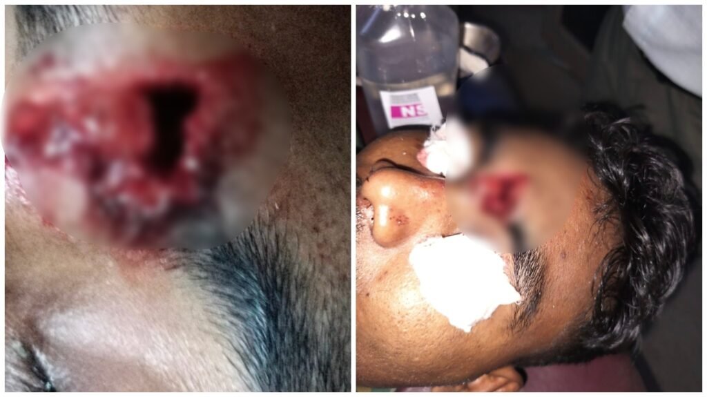 Protest Violence: Unrest in Sakti... Outrage Erupts Following Child's Death... Attack with Bricks and Stones; Constable Sustains Head Injury.