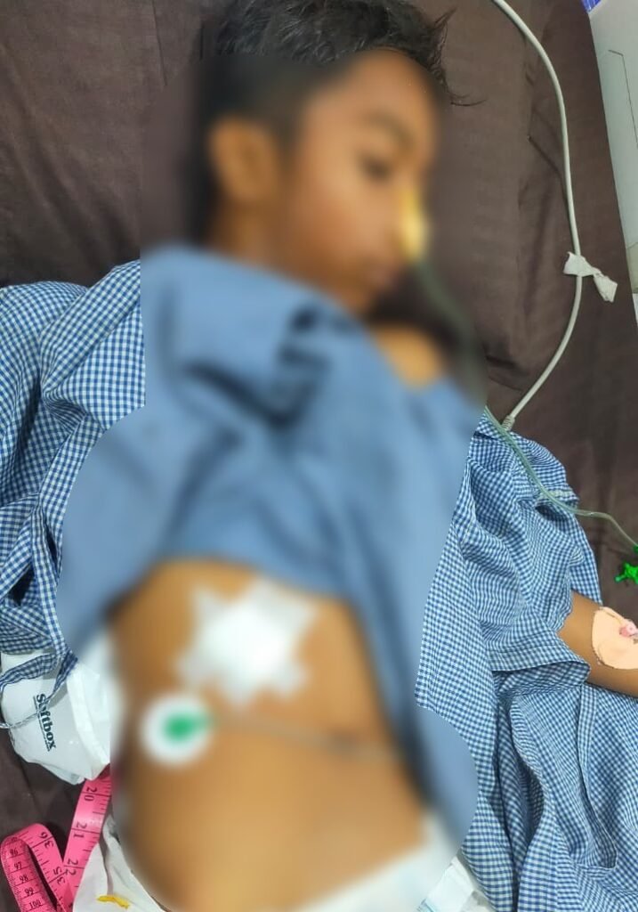 Knife Attack : ब्रेकिंग…रायपुर में चाकूबाजी से सनसनी…! पुरानी रंजिश में युवक पर जानलेवा हमला…यहां देखें CCTV में कैद खौफनाक वारदात Knife Attack: Breaking News... Sensation in Raipur Following Stabbing Incident! Life-Threatening Attack on Youth Stemming from Old Enmity... Watch the Horrific Incident, Captured on CCTV, Here.