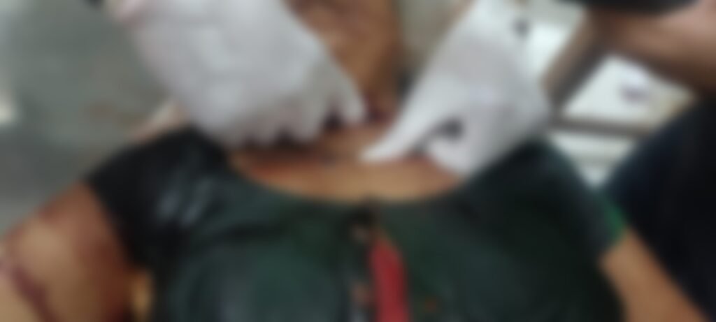 Gariaband Murder Case : गरियाबंद में सनसनी…! ब्लेड से गर्दन काट मितानिन की हत्या…बचाने पहुंचे पति-बेटों पर भी हमला…VIDEO Gariaband Murder Case: Sensation in Gariaband! Community Health Worker Murdered—Throat Slit with a Blade; Husband and Sons Attacked While Attempting to Save Her... VIDEO
