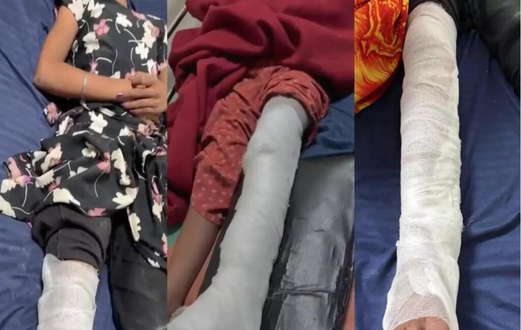 Wall Collapse : रायपुर में बड़ा हादसा…! दीवार गिरने से 3 मासूम बच्चियां घायल…एक का पैर बुरी तरह जख्मी Wall Collapse: Major Tragedy in Raipur...! 3 Young Girls Injured After Wall Collapses... One Suffers Severe Leg Injury.