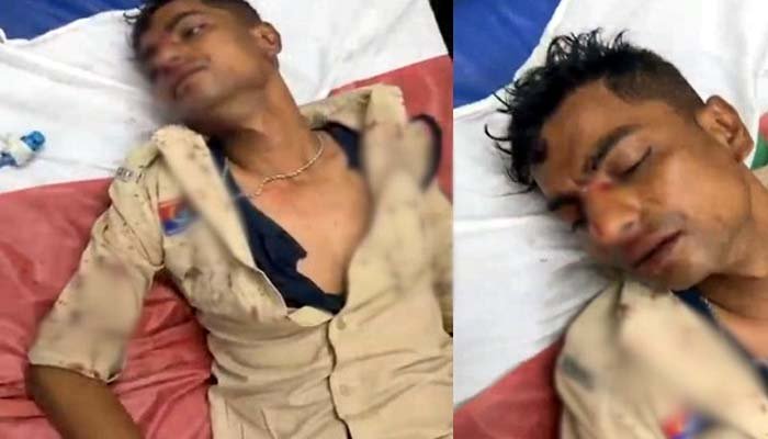 डायल-112 के आरक्षक पर हमला, सिर और आंख में गंभीर चोट; आरोपी गिरफ्तार डायल-112 के आरक्षक पर हमला