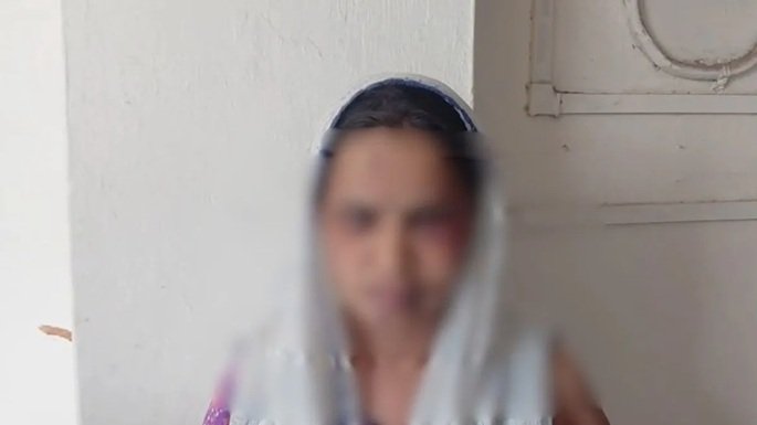 Cruel SAF Jawan : चरित्र शंका में दरिंदा बना SAF जवान…! पत्नी को बांधकर गर्म प्रेस से 7 बार दागा…हैवानियत सुन कांप उठे लोग Cruel SAF Jawan: SAF Constable Turns Monster Over Suspicion of Character! Ties Up Wife and Branded Her Seven Times with a Hot Iron—People Shudder in Horror Upon Hearing of This Brutality.