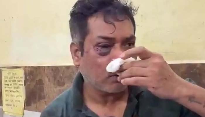 कांग्रेस नेता के घर घुसकर हमला, नेता और पत्नी घायल; 15-20 लोगों पर मारपीट का आरोप