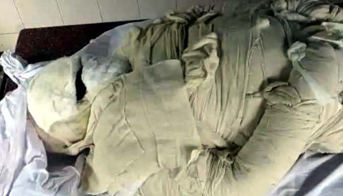 1500 डिग्री गर्म पिघला लोहा शरीर पर गिरा, स्टील प्लांट में ठेकेदार की मौत पिघला लोहा गिरने से ठेकेदार की मौत